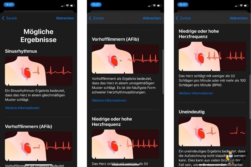 Man sieht die EKG-Funktion auf dem iPhone.